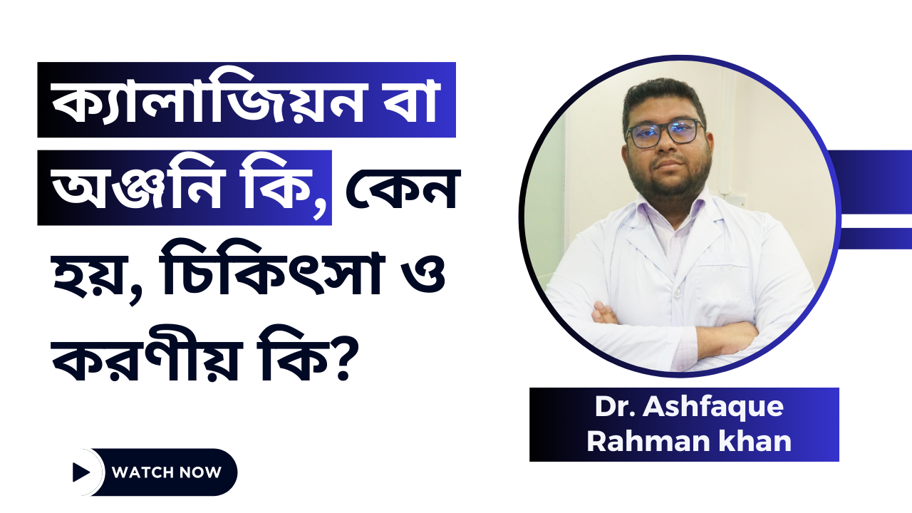 ক্যালাজিয়ন বা অঞ্জনি কি, কেন হয়, চিকিৎসা ও করণীয় কি