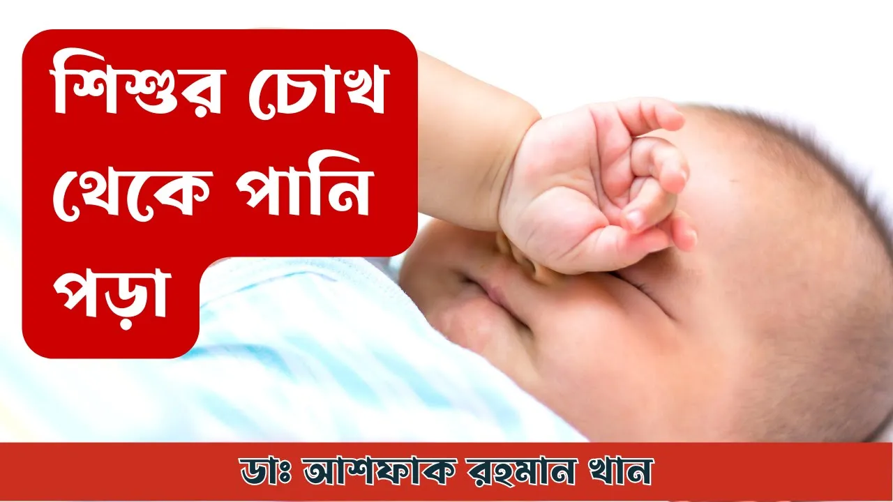 শিশুর চোখ থেকে পানি পড়া
