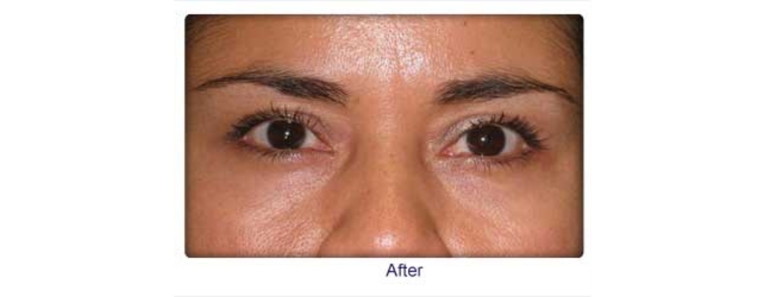 Eye Specialist Dr. Ashfaque Rahman Khan