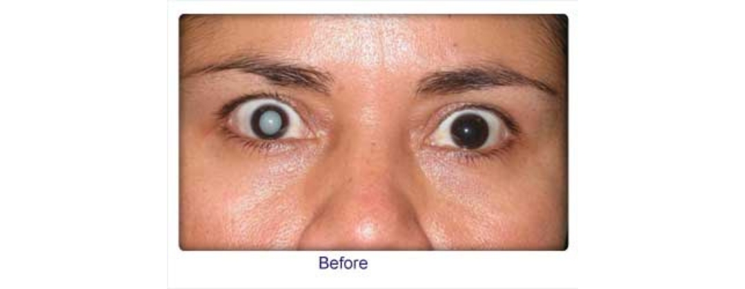 Eye Specialist Dr. Ashfaque Rahman Khan