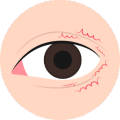 Eye Specialist Dr. Ashfaque Rahman Khan