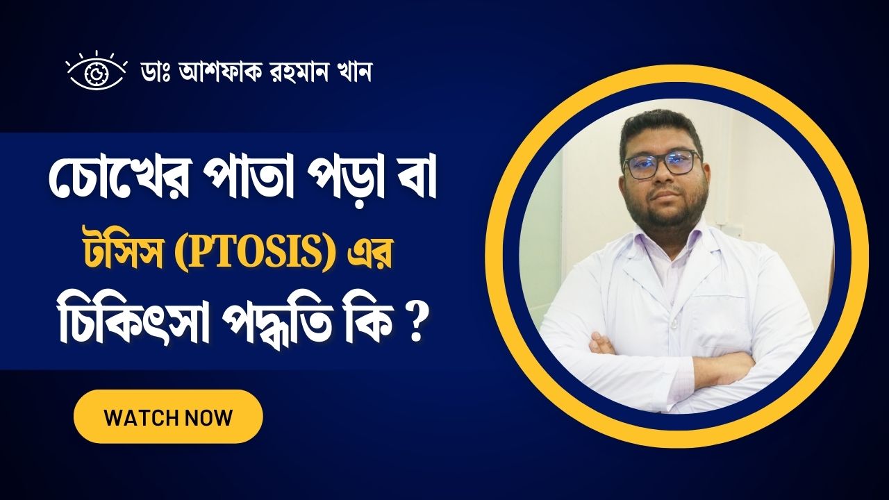 চোখের পাতা পড়া বা টসিস (Ptosis) এর চিকিৎসা পদ্ধতি কি