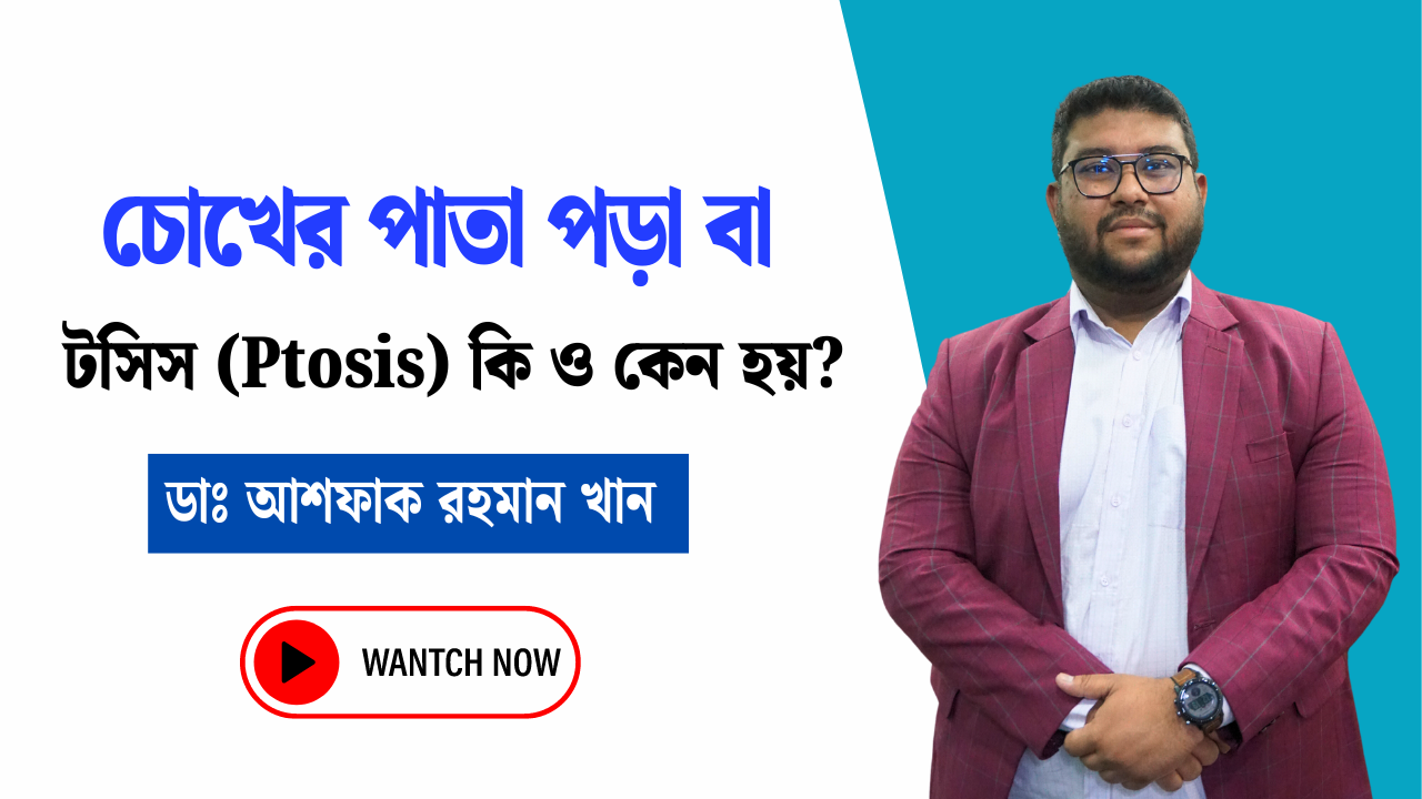 টসিস (Ptosis) কি ও কেন হয়