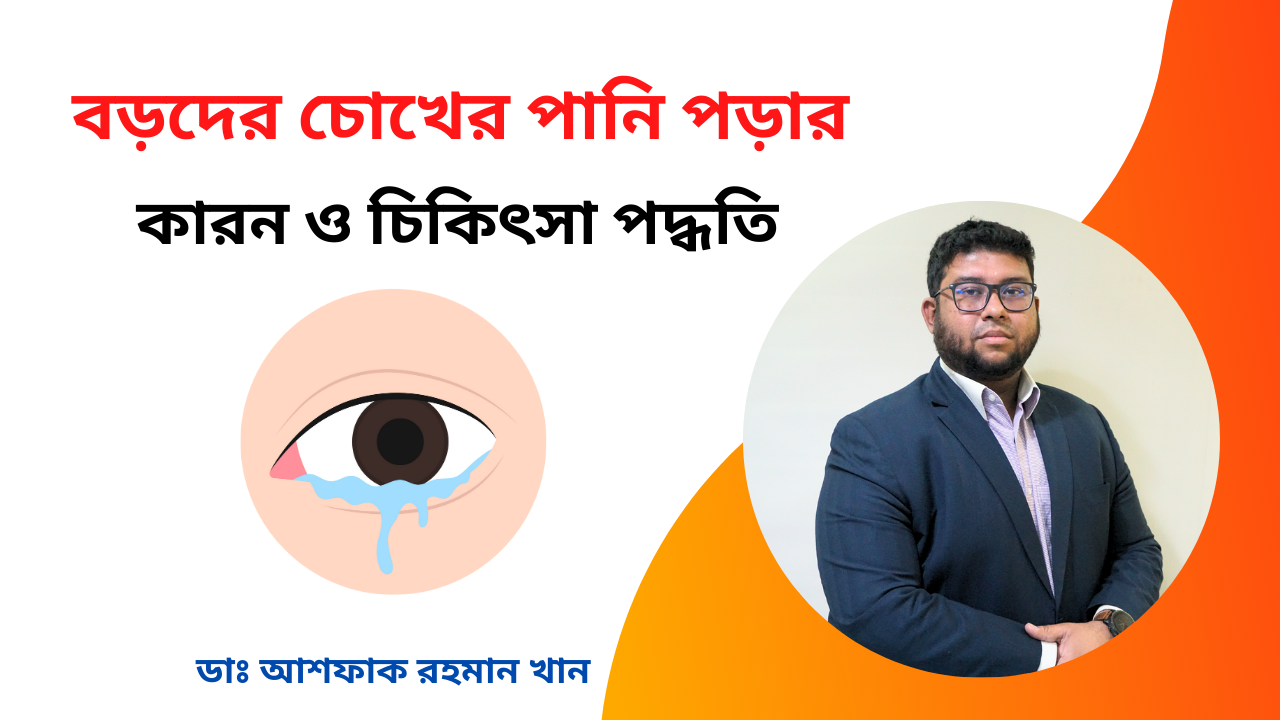 বড়দের চোখের পানি পড়ার কারন ও চিকিৎসা পদ্ধতি