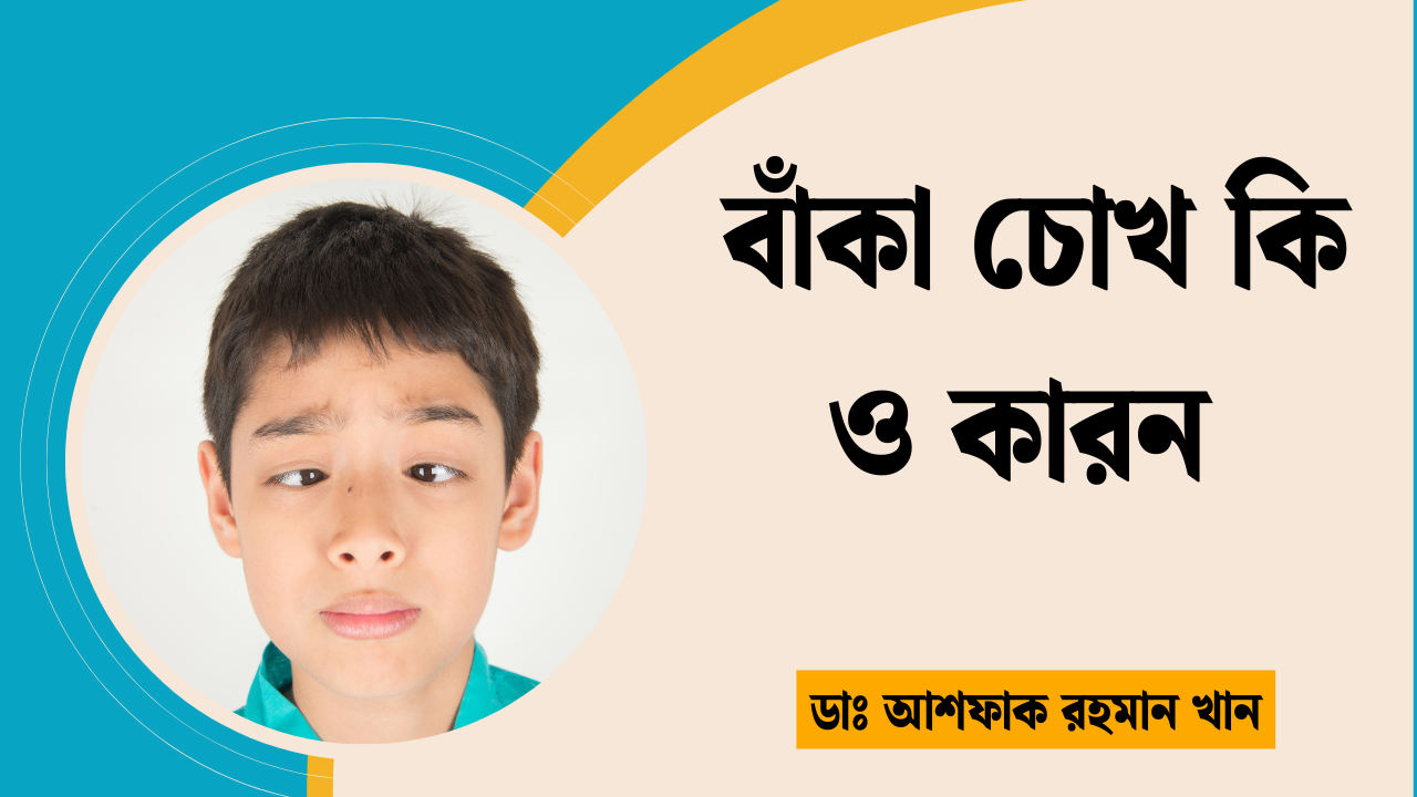 বাঁকা চোখ কি ও কারন