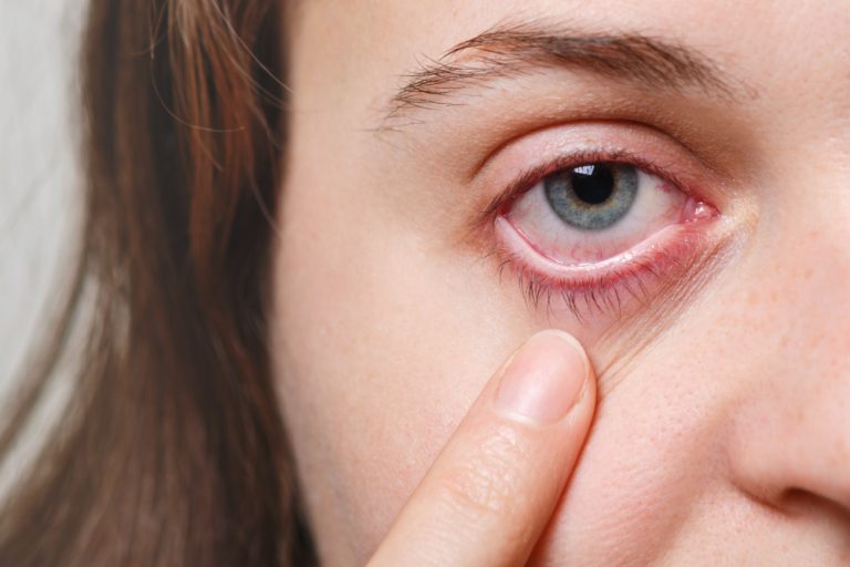 can chemo change eye color